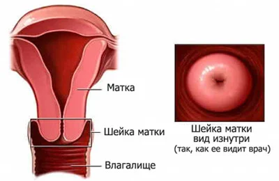 Как избежать тяжелых последствий после операции по удалению матки у женщин