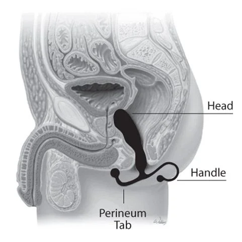 article-prostate-induced-orgasms-1