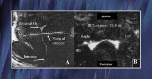Базовые размеры человеческого влагалища