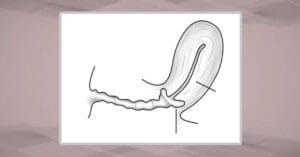 Генитальная рефлексология - Экстатический точечный массаж