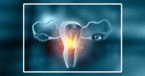 Что такое проникновение в шейку матки?