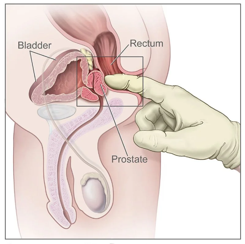 article-everything-about-male-g-spot-2
